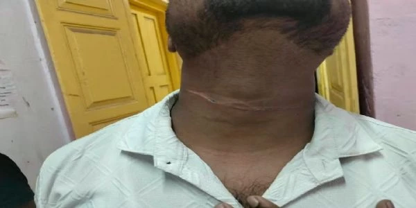 Man Injured By Illegal Chinese Manjha In Uttarpara
